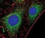 PKC alpha Antibody in Immunocytochemistry (ICC/IF)