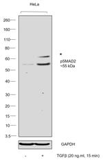 Phospho-SMAD2 (Ser245, Ser250, Ser255) Antibody in Western Blot (WB)