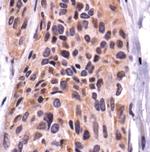 FAK Antibody in Immunohistochemistry (Paraffin) (IHC (P))