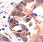 PABP Antibody in Immunohistochemistry (Paraffin) (IHC (P))