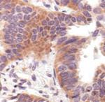 COX2 Antibody in Immunohistochemistry (Paraffin) (IHC (P))