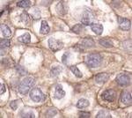 Cortactin Antibody in Immunohistochemistry (Paraffin) (IHC (P))