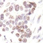 H2BK20ac Antibody in Immunohistochemistry (Paraffin) (IHC (P))