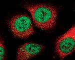 Phospho-STAT3 (Ser727) Antibody in Immunocytochemistry (ICC/IF)