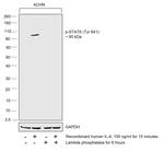 Phospho-STAT6 (Tyr641) Antibody