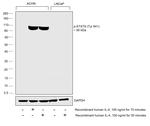 Phospho-STAT6 (Tyr641) Antibody in Western Blot (WB)