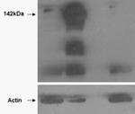 Tankyrase Antibody in Western Blot (WB)