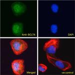 BCL7A Antibody in Immunocytochemistry (ICC/IF)