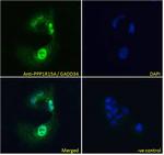 GADD34 Antibody in Immunocytochemistry (ICC/IF)