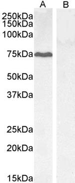 GADD34 Antibody in Western Blot (WB)