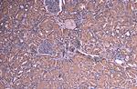 SOCS1 Antibody in Immunohistochemistry (Paraffin) (IHC (P))