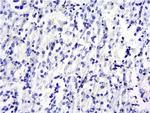 SOCS1 Antibody in Immunohistochemistry (Paraffin) (IHC (P))