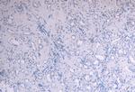 SOCS1 Antibody in Immunohistochemistry (Paraffin) (IHC (P))