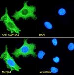 ALDH1A1 Antibody in Immunocytochemistry (ICC/IF)