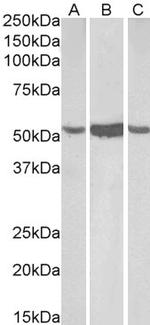 ALDH1A1 Antibody in Western Blot (WB)