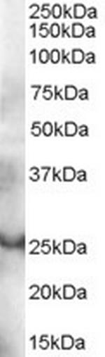 GRAP Antibody in Western Blot (WB)