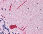 SHP2 Antibody in Immunohistochemistry (Paraffin) (IHC (P))