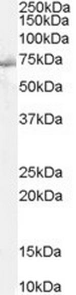 SHP2 Antibody in Western Blot (WB)