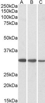 CAPZB Antibody in Western Blot (WB)