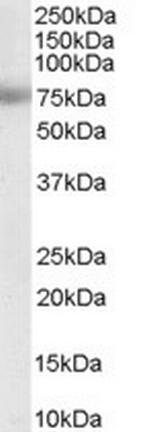 MTA1 Antibody in Western Blot (WB)