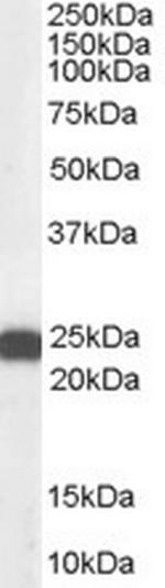 BAG2 Antibody in Western Blot (WB)