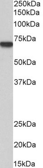 MTM1 Antibody in Western Blot (WB)