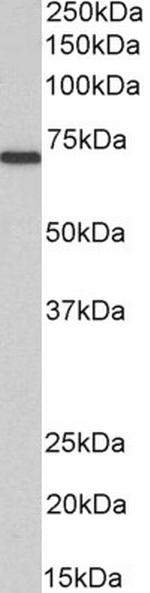 MTM1 Antibody in Western Blot (WB)