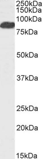 FOXP2 Antibody in Western Blot (WB)