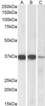 PP2A alpha/beta Antibody in Western Blot (WB)