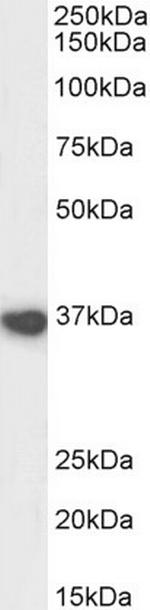 ATF4 Antibody in Western Blot (WB)