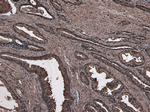 NUMB Antibody in Immunohistochemistry (Paraffin) (IHC (P))