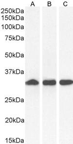 NQO1 Antibody in Western Blot (WB)