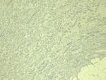 IRF6 Antibody in Immunohistochemistry (Paraffin) (IHC (P))