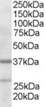 p41-ARCb Antibody in Western Blot (WB)