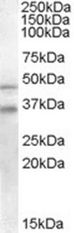 GULP1 Antibody in Western Blot (WB)