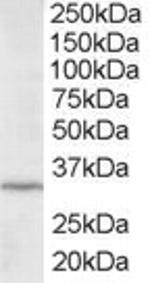 ING2 Antibody in Western Blot (WB)