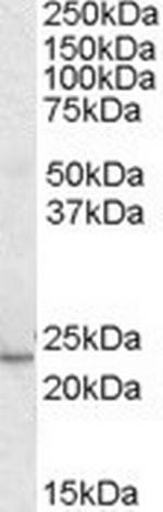 KLF16 Antibody in Western Blot (WB)