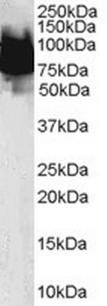 KLF4 Antibody in Western Blot (WB)