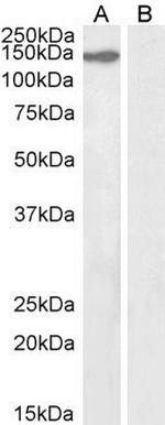 KIF4A Antibody in Western Blot (WB)