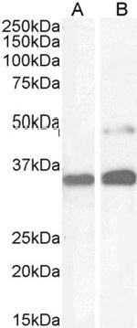 PAX8 Antibody in Western Blot (WB)