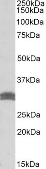 CBR1 Antibody in Western Blot (WB)