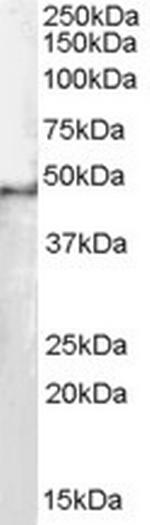 SF3B4 Antibody in Western Blot (WB)