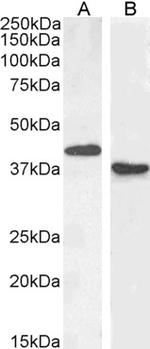 PAX5 Antibody in Western Blot (WB)