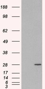 RAB11A Antibody in Western Blot (WB)