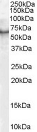 p70 S6 Kinase Antibody in Western Blot (WB)