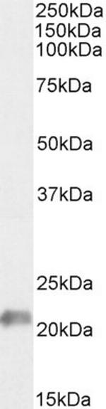 JWA Antibody in Western Blot (WB)