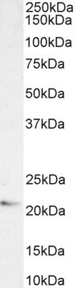 JWA Antibody in Western Blot (WB)