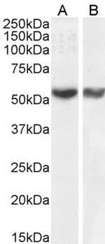 RNF8 Antibody in Western Blot (WB)