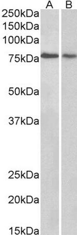 BERP Antibody in Western Blot (WB)