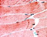 MURF1 Antibody in Immunohistochemistry (Paraffin) (IHC (P))